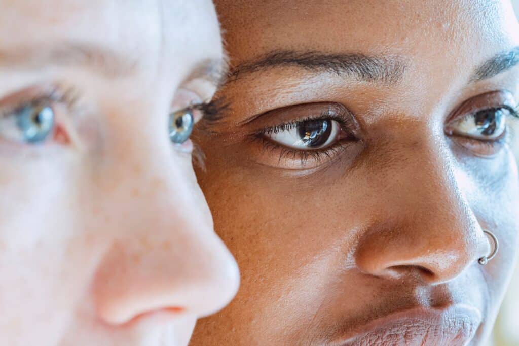 macchie solari sul viso trattamento skincare